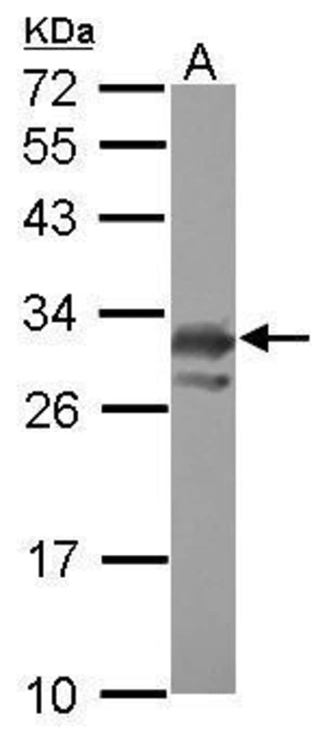 Anti-PCMT1