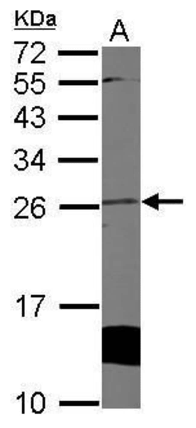 Anti-Cytoglobin