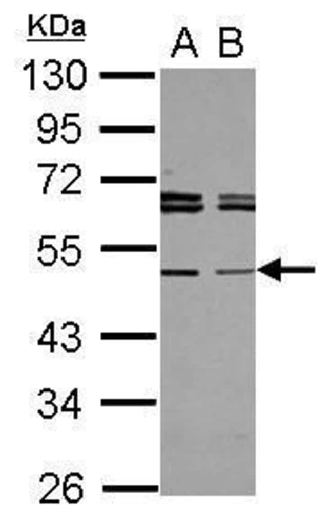 Anti-Tapasin related protein