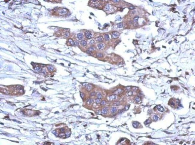 ANTI-RNASE H1