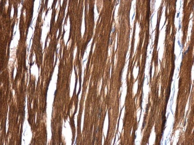 Anti-MRRF