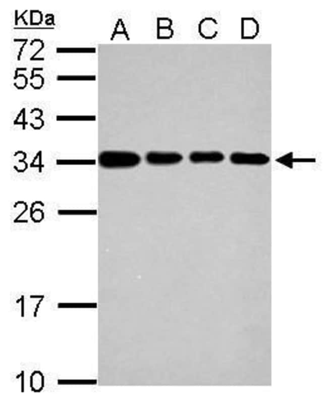 Anti-IFI35