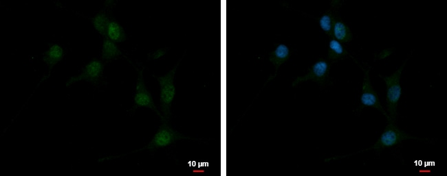 Anti-EBF3