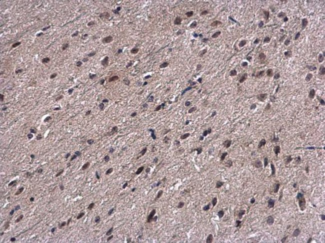 Anti-Proteasome 20S beta 7