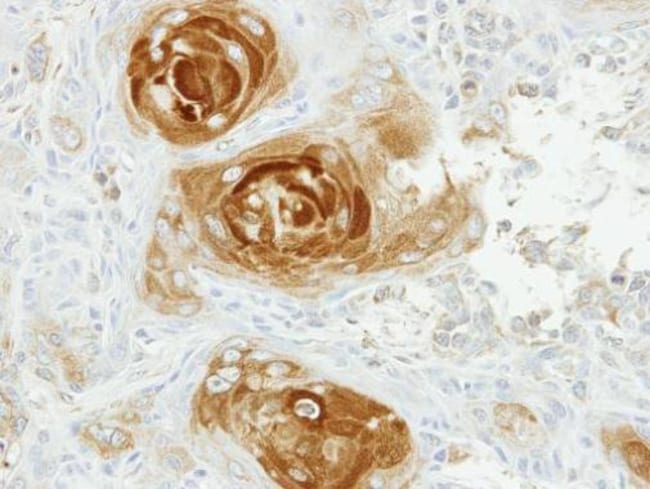 Anti-APPBP2