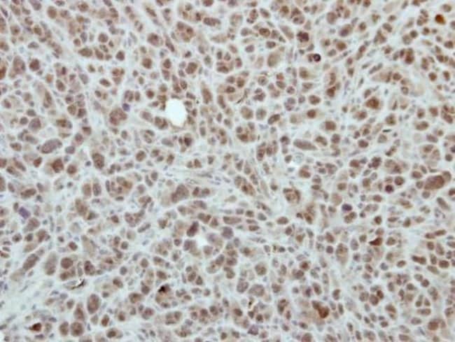 Anti-RPP30