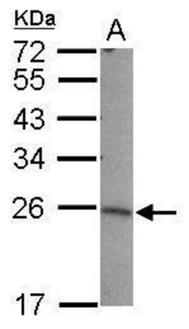 Anti-LIN7B
