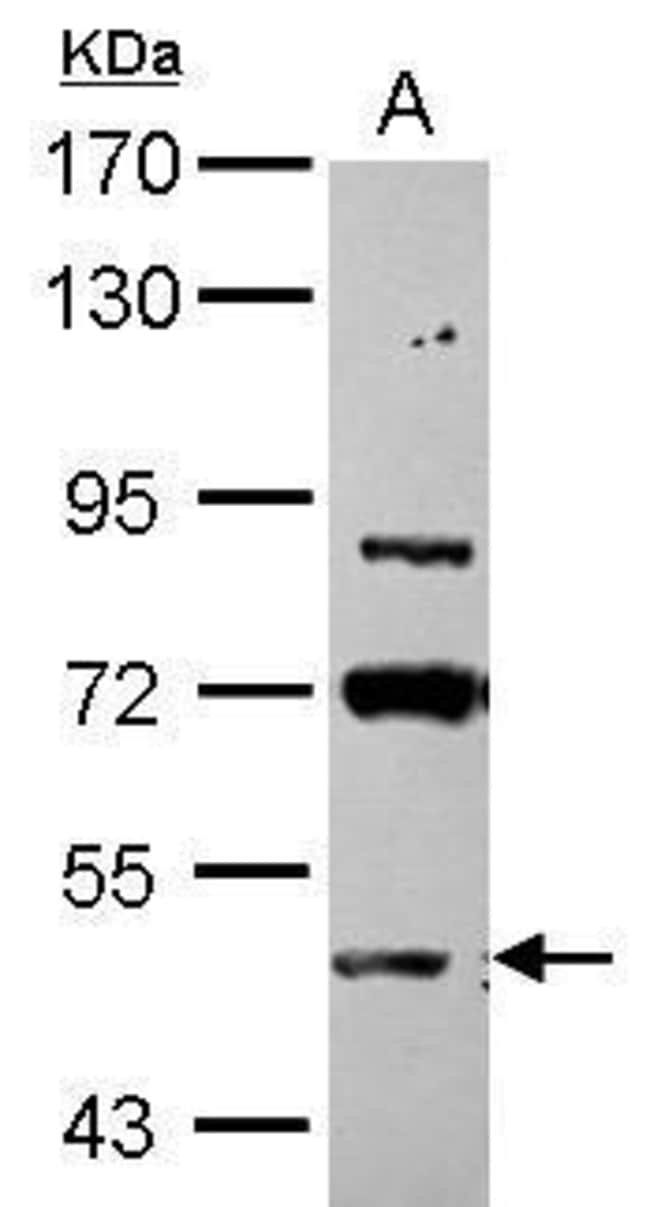 Anti-ASB3
