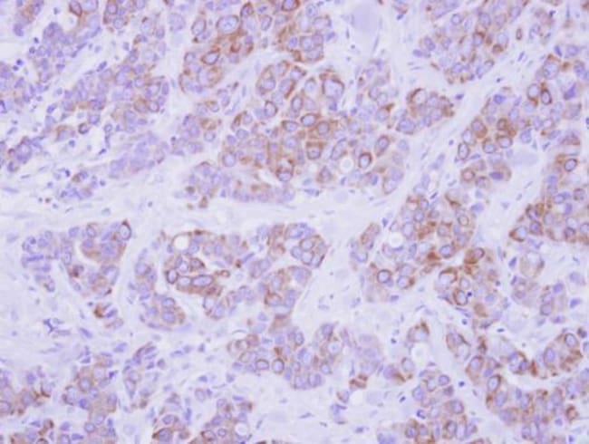 Anti-Cytokeratin 2