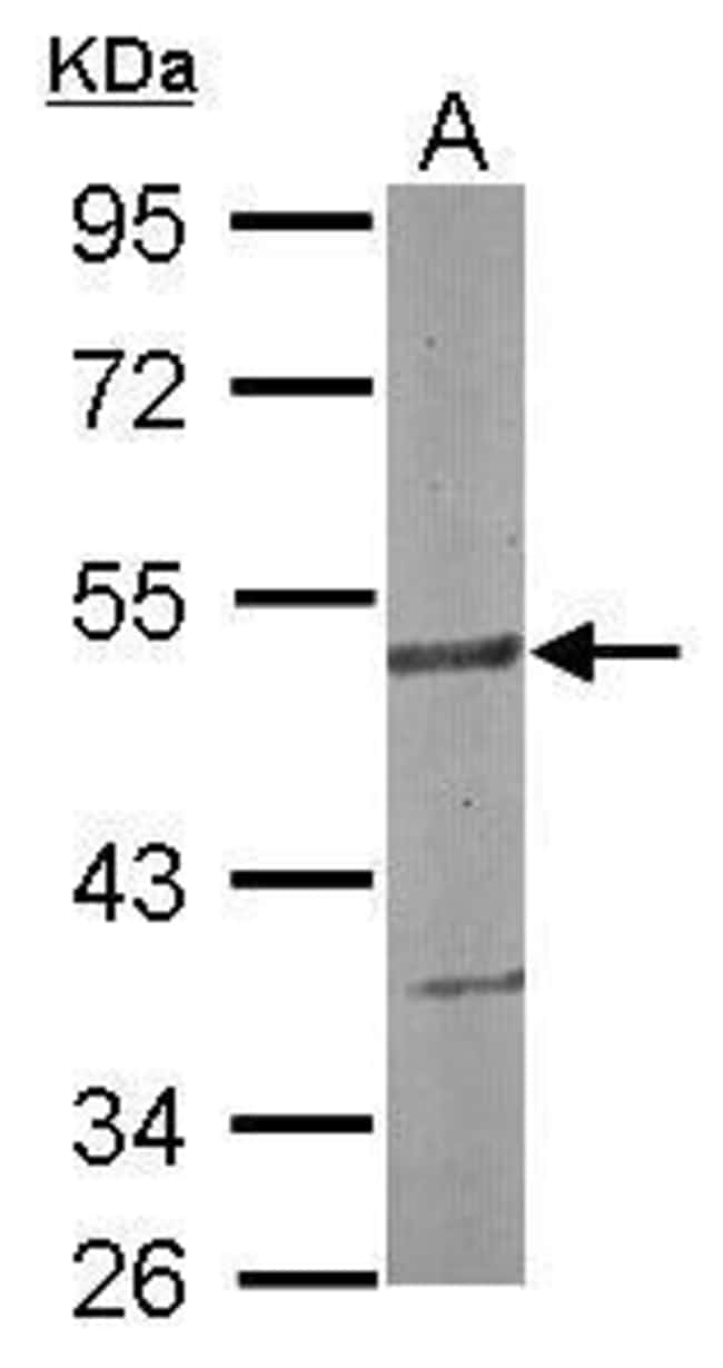 Anti-SMARCD3