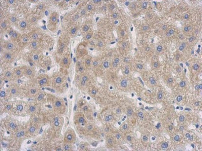 Anti-SENP8