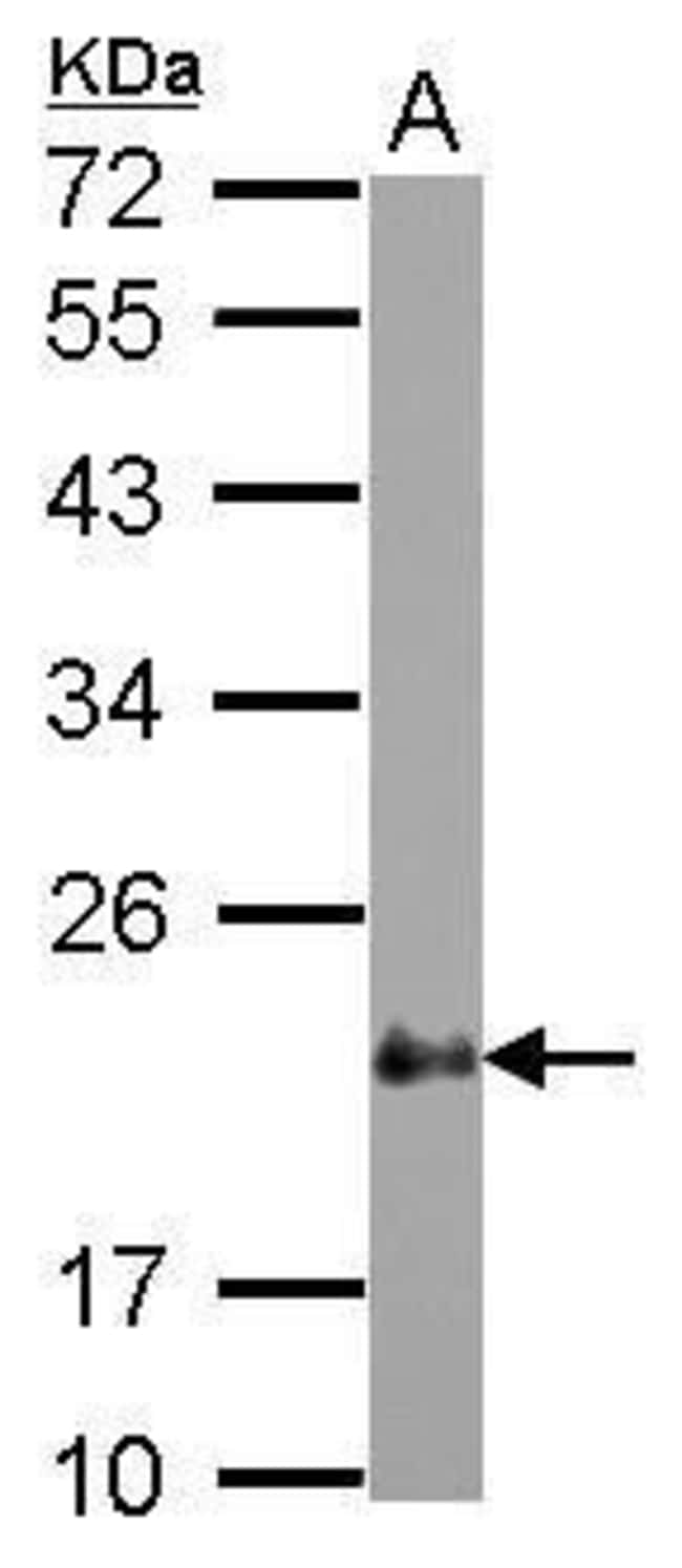 Anti-CSRP2
