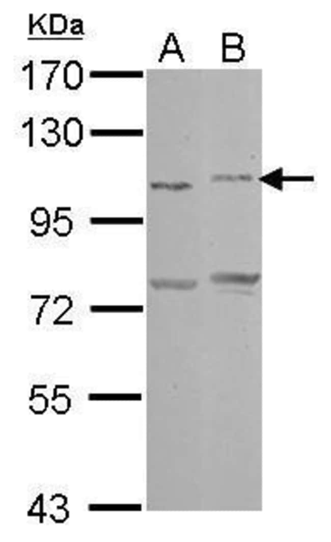 Anti-PCDHAC2