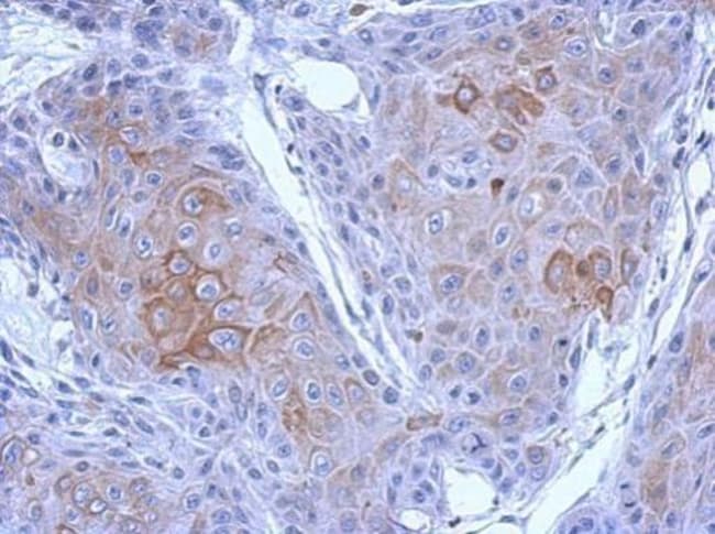 Anti-PCDH10