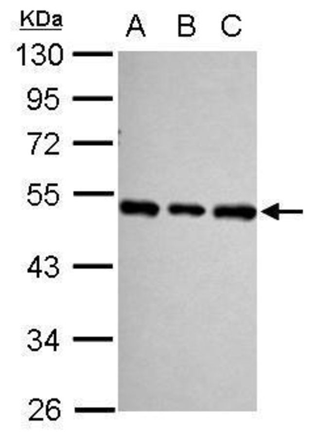 Anti-SF3B4