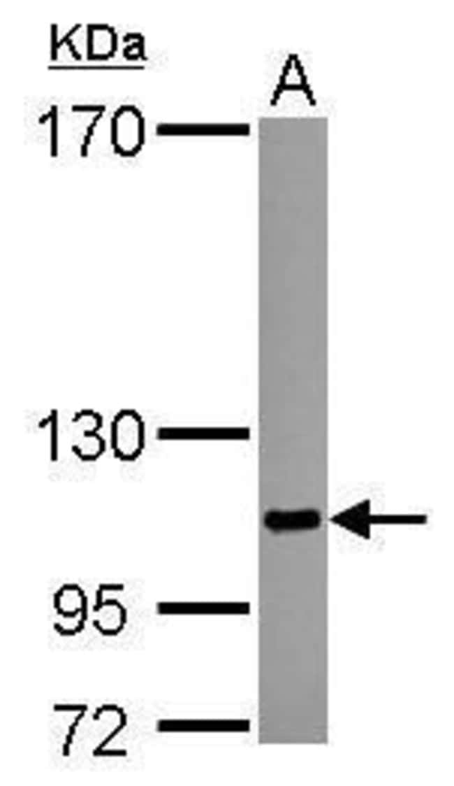 Anti-SENP5