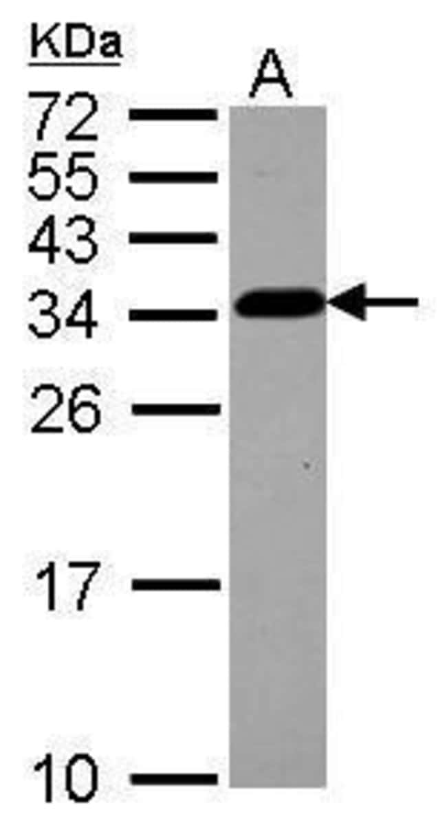 Anti-CKAP1