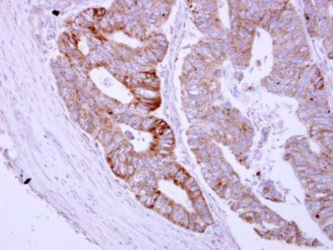Anti-ASB8