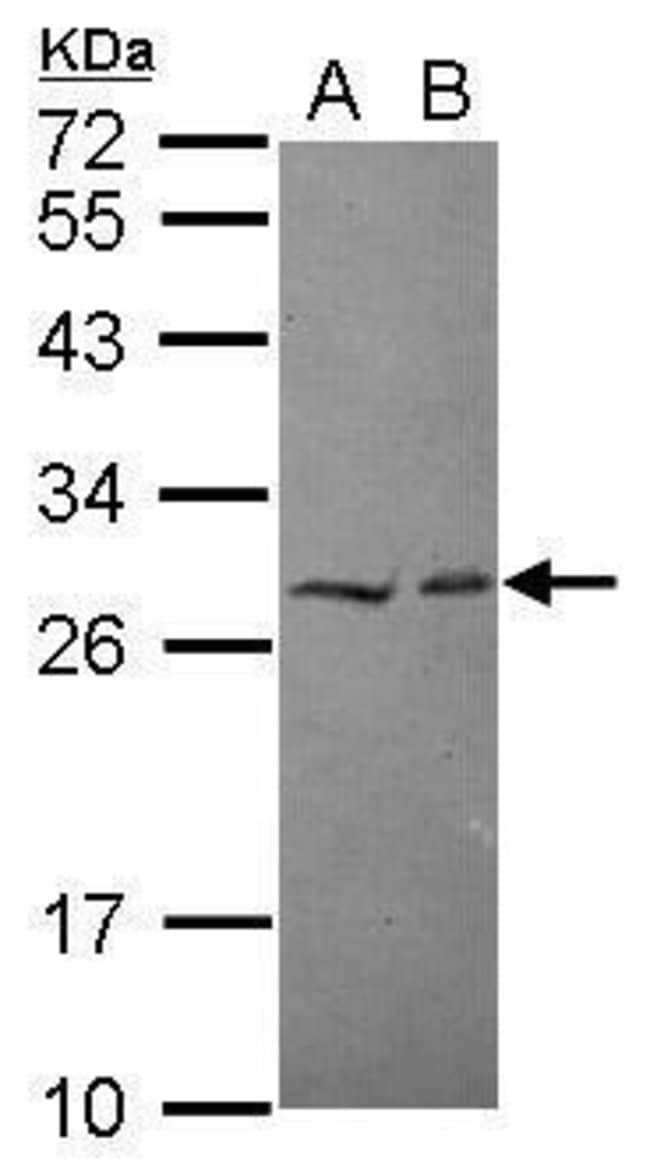 Anti-HECTD2