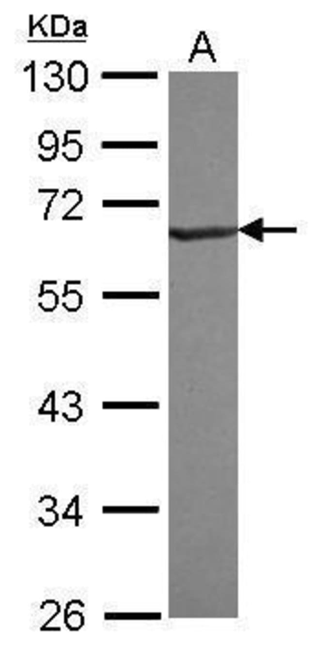 Anti-RNF25