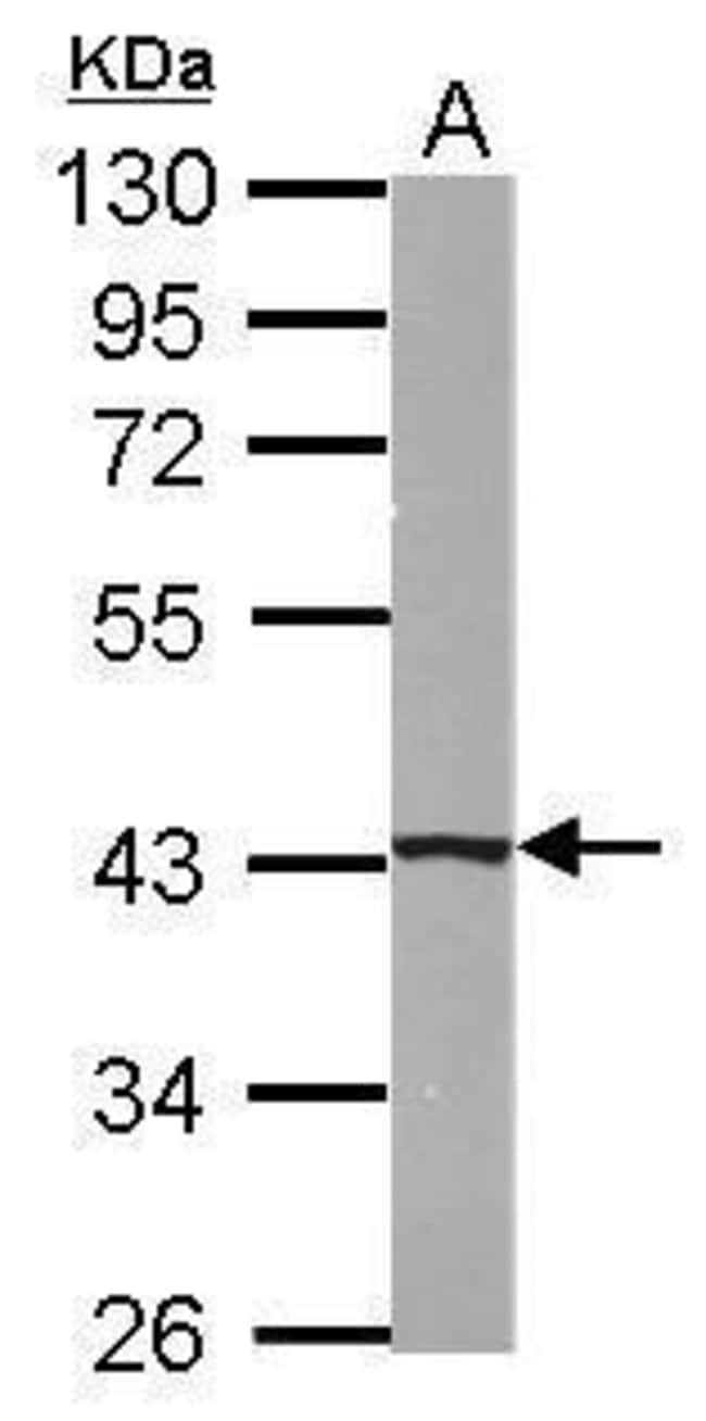 Anti-B4GALT5