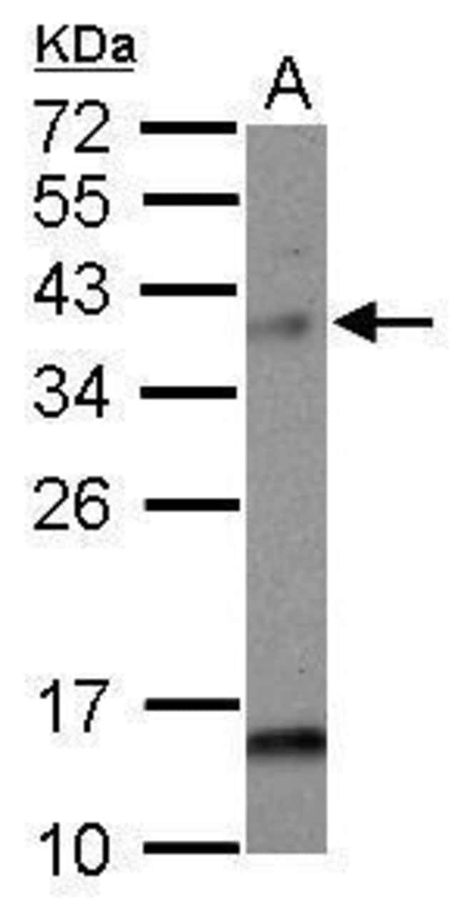 Anti-MAD2L1 binding protein