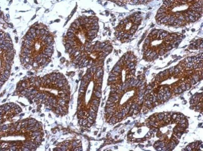 Anti-MRPS18B