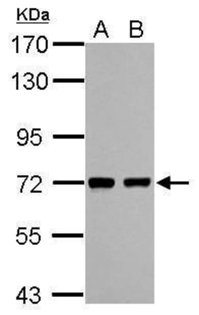 Anti-HCC1