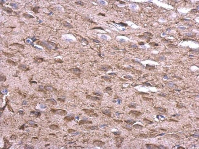 Anti-KLHL25