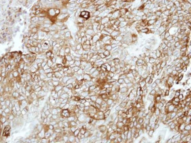 Anti-PCDHB16