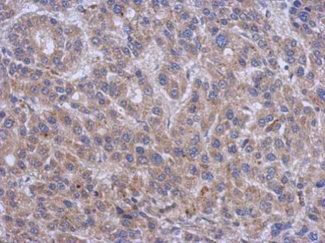 ANTI-SERINE PALMITOYLTRANSFERASE 2