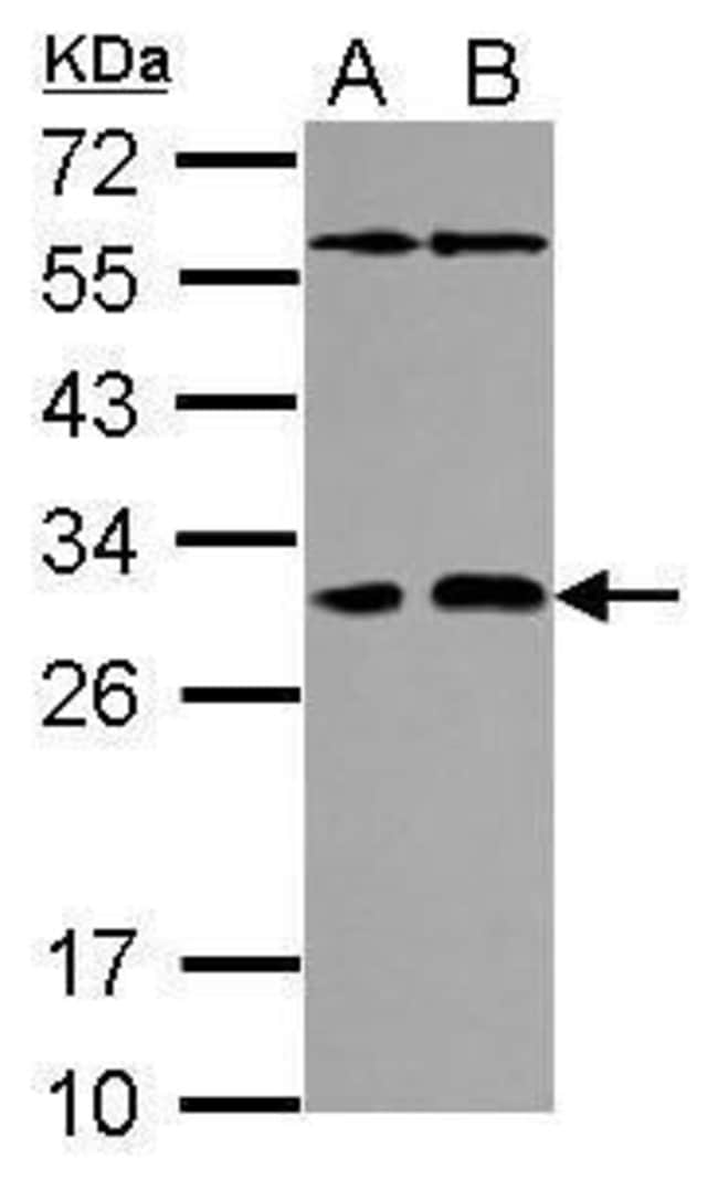 Anti-PAFAH1B2