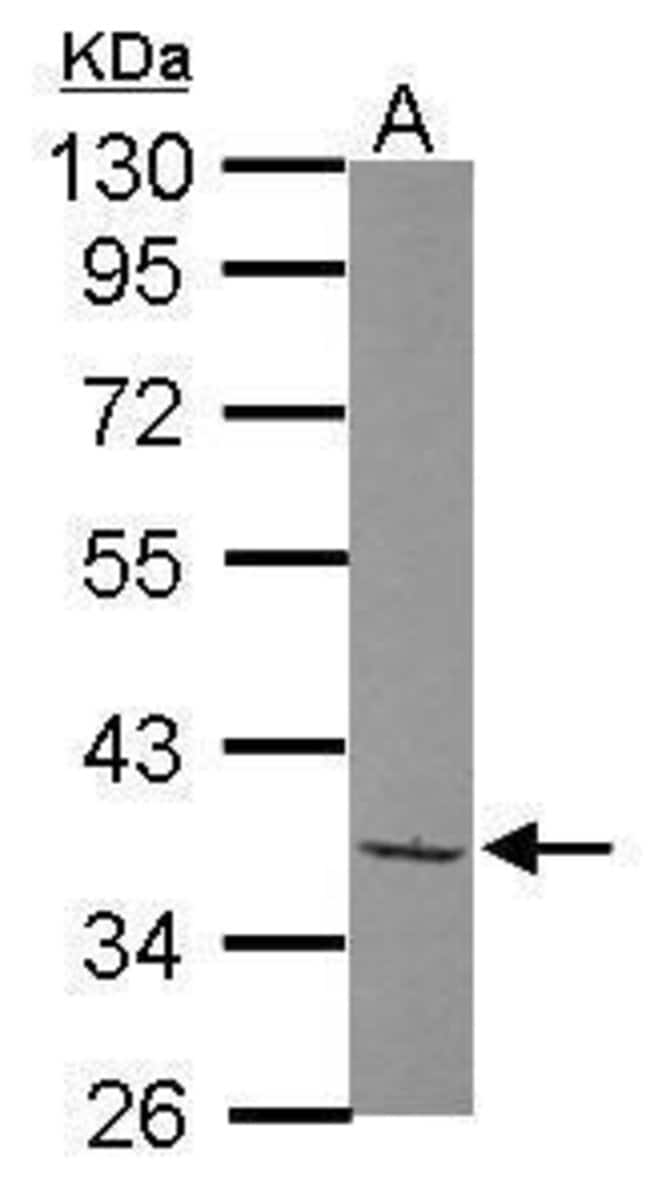 Anti-TAF148