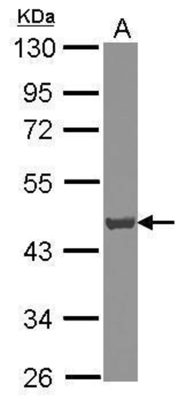 Anti-ATP6V0D1