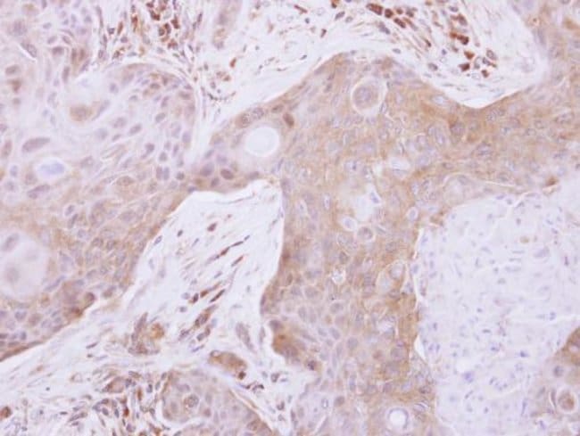 Anti-TXNL2