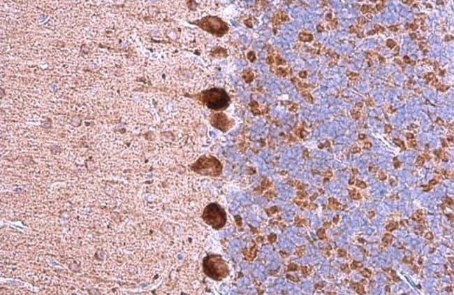 ANTI-GABA A RECEPTOR ALPHA 5