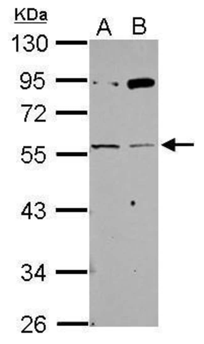 Anti-AChR gamma