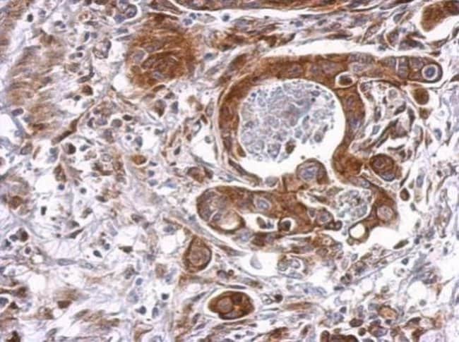 Anti-Cyclophilin B