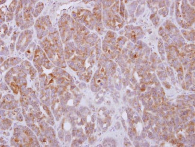 Anti-G protein alpha 16