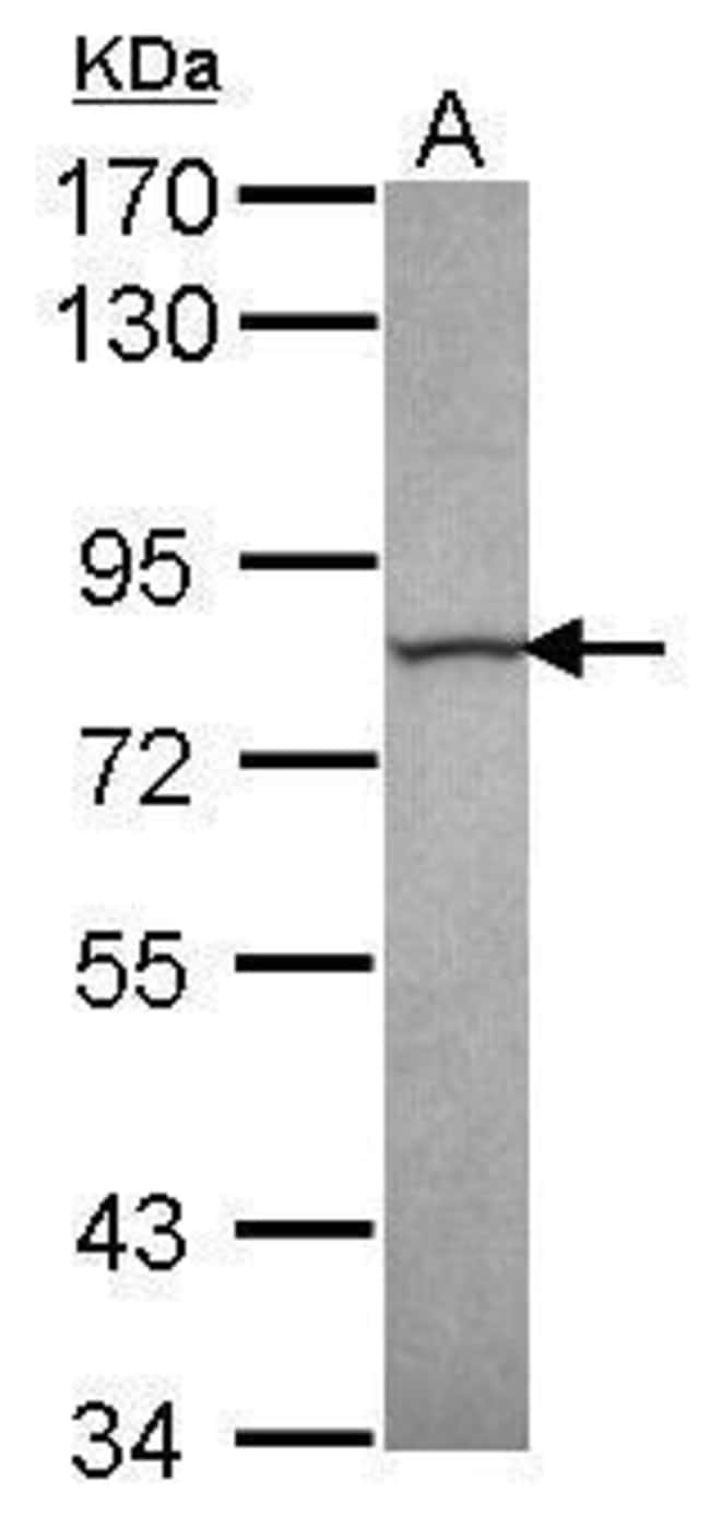 Anti-Calpain 13