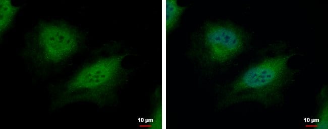Anti-CSRP2BP
