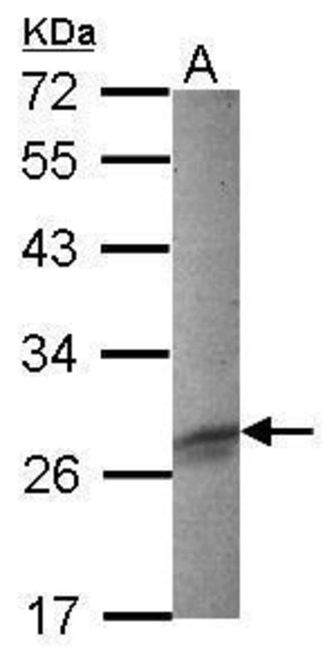 Anti-FHL3