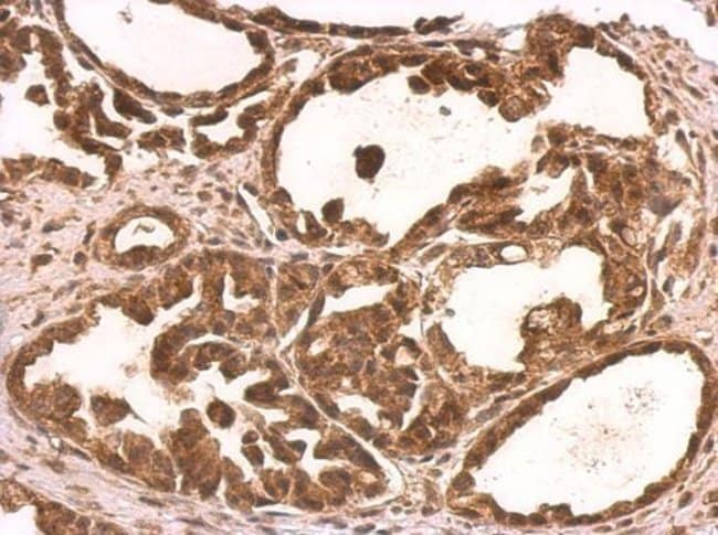 Anti-NUFIP1