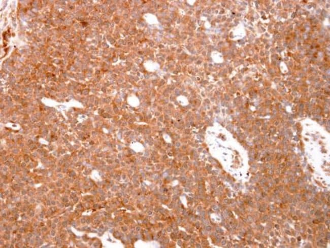 Anti-GSTO1
