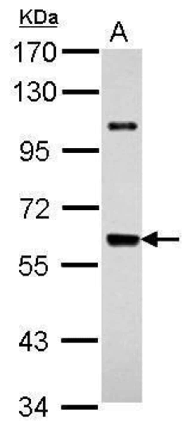 Anti-UAP1