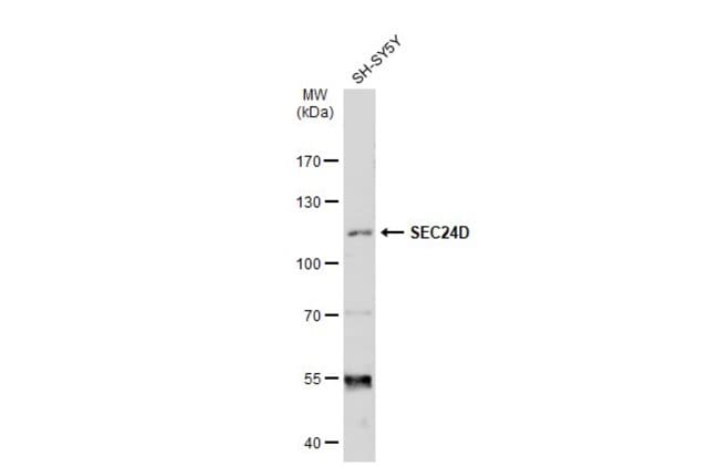 Anti-SEC24D