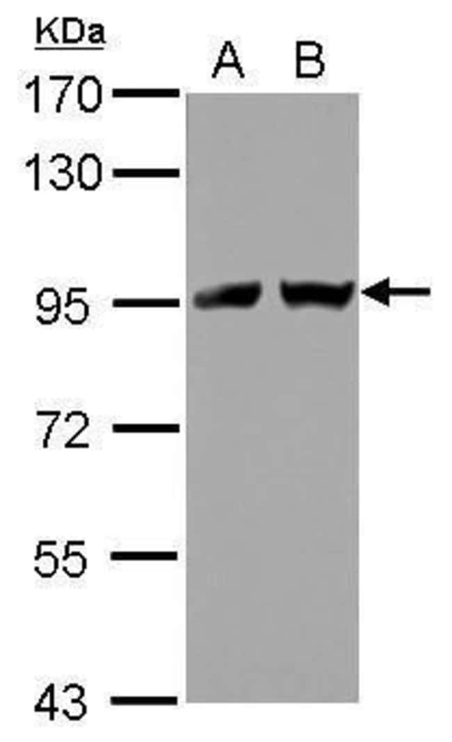 Anti-TNPO2