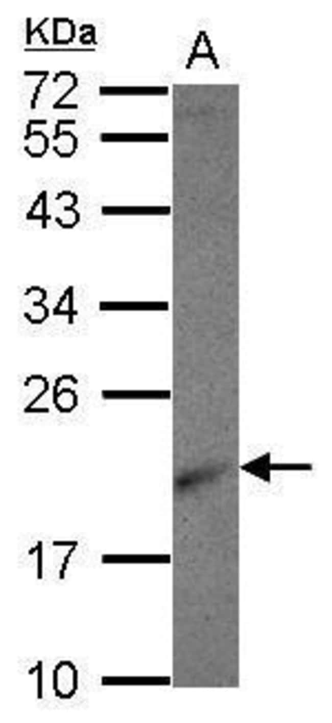 Anti-ribosomal protein L26