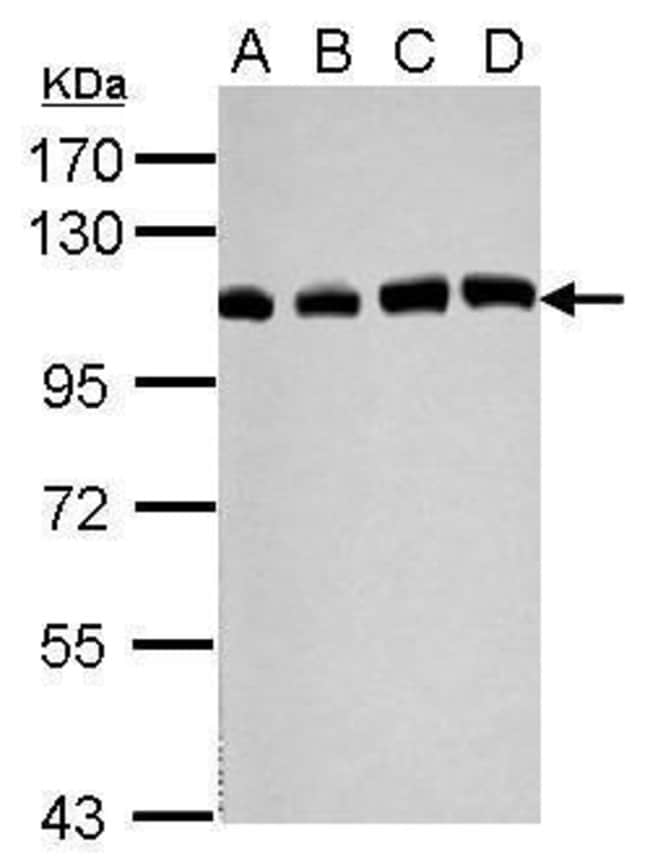 Anti-USP13