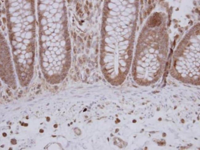 Anti-GTPBP9